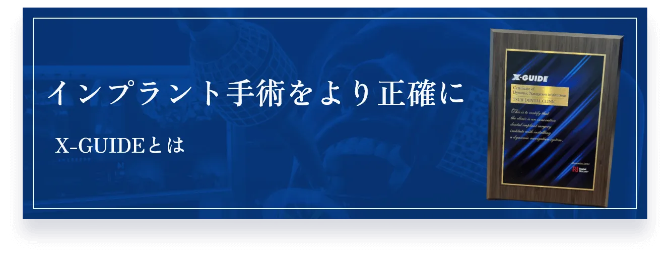 インプラント手術をより正確にX-GUIDEとは