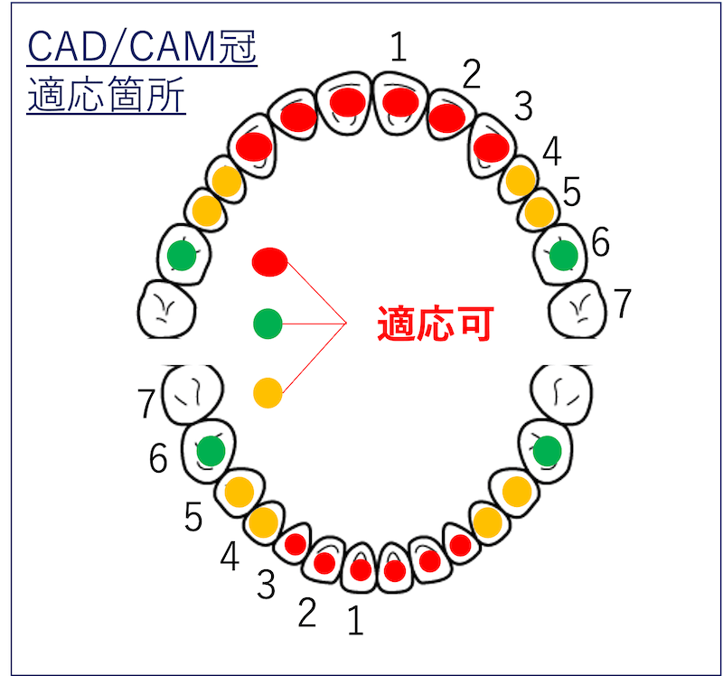 CAD/CAM冠適応箇所