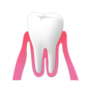 STAGE1：健康な歯