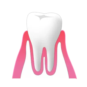 STAGE1：健康な歯